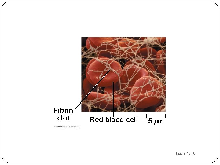 Fibrin clot Red blood cell 5 m Figure 42. 18 