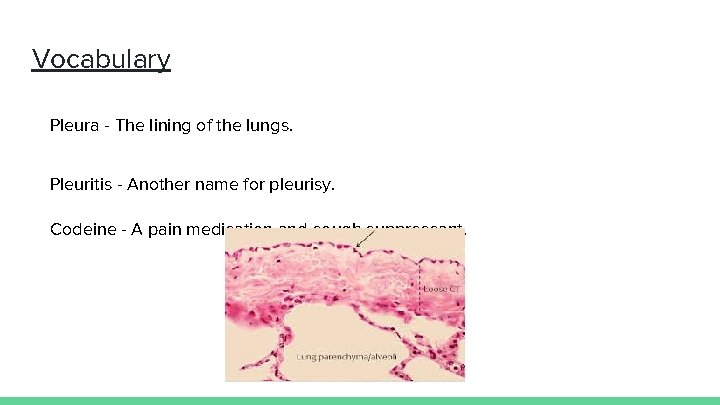 Vocabulary Pleura - The lining of the lungs. Pleuritis - Another name for pleurisy.