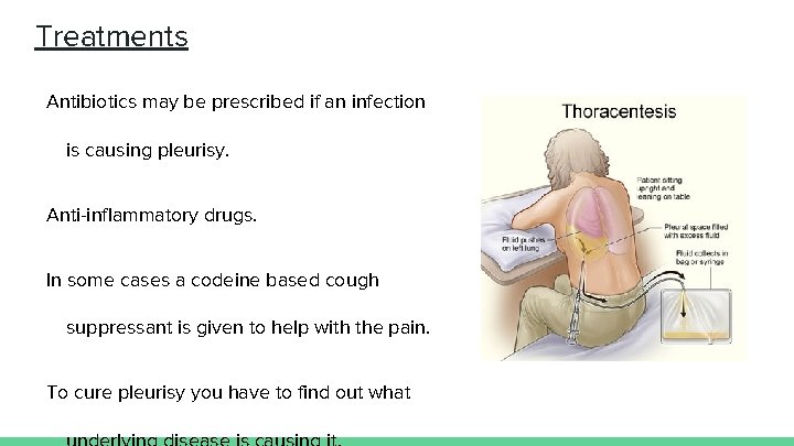 Treatments Antibiotics may be prescribed if an infection is causing pleurisy. Anti-inflammatory drugs. In