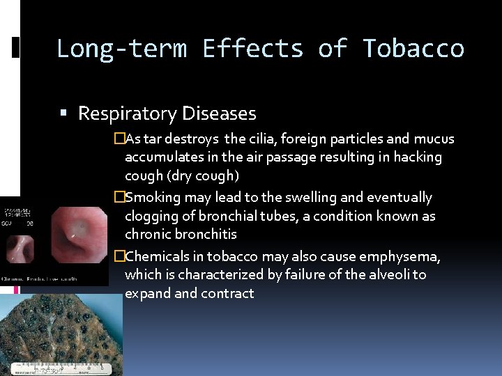 Long-term Effects of Tobacco Respiratory Diseases �As tar destroys the cilia, foreign particles and