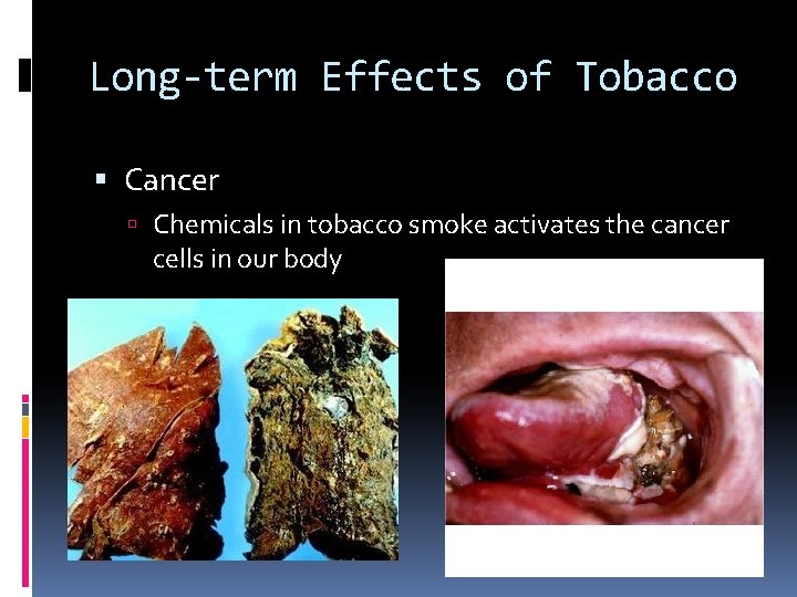 Long-term Effects of Tobacco Cancer Chemicals in tobacco smoke activates the cancer cells in