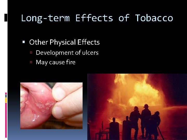 Long-term Effects of Tobacco Other Physical Effects Development of ulcers May cause fire 