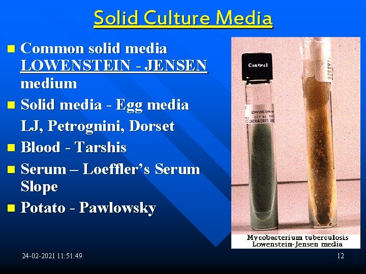 Solid Culture Media Common solid media LOWENSTEIN - JENSEN medium n Solid media -