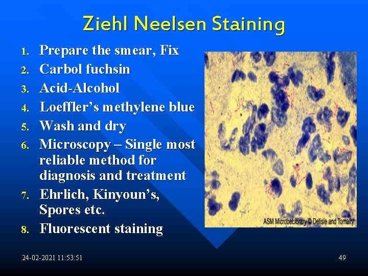 Ziehl Neelsen Staining 1. 2. 3. 4. 5. 6. 7. 8. Prepare the smear,