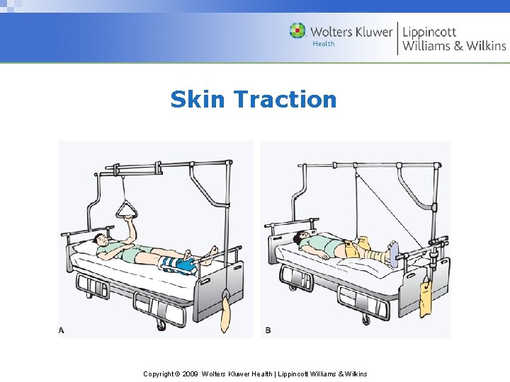 Skin Traction Copyright © 2009 Wolters Kluwer Health | Lippincott Williams & Wilkins 