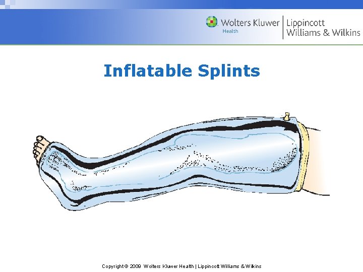 Inflatable Splints Copyright © 2009 Wolters Kluwer Health | Lippincott Williams & Wilkins 