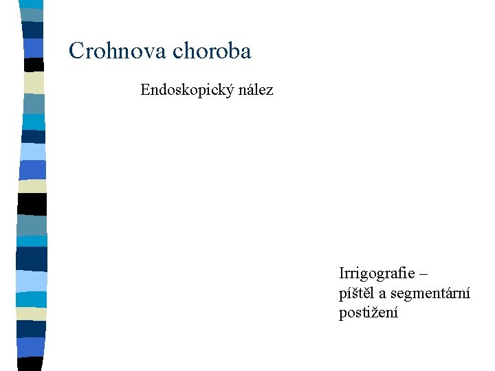 Crohnova choroba Endoskopický nález Irrigografie – píštěl a segmentární postižení 