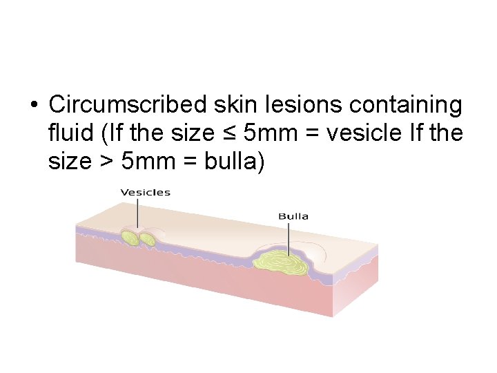  • Circumscribed skin lesions containing fluid (If the size ≤ 5 mm =