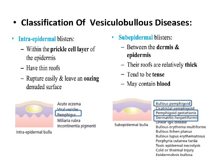  • Classification Of Vesiculobullous Diseases: 