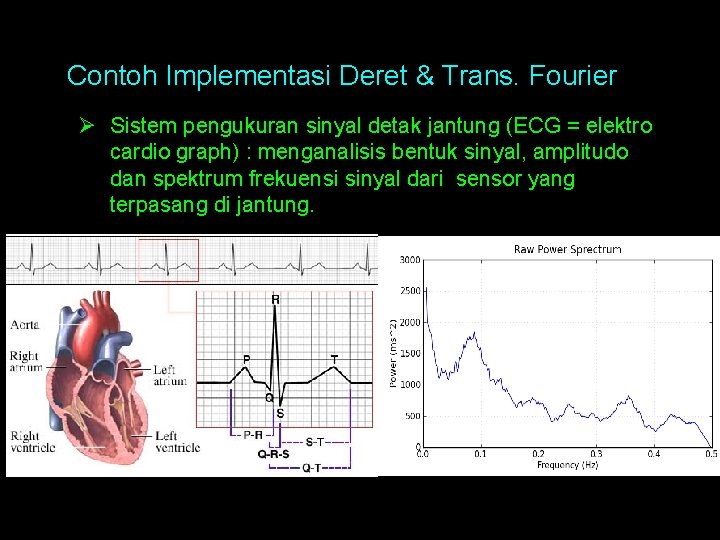 Contoh Implementasi Deret & Trans. Fourier Ø Sistem pengukuran sinyal detak jantung (ECG =