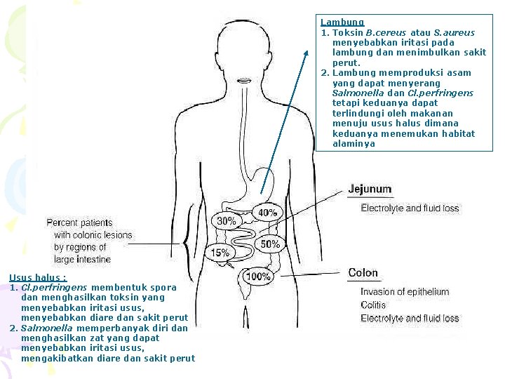 Lambung 1. Toksin B. cereus atau S. aureus menyebabkan iritasi pada lambung dan menimbulkan