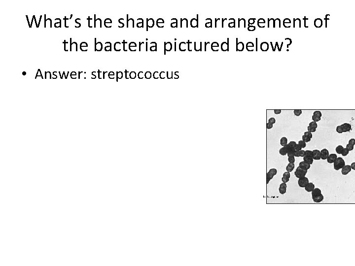 What’s the shape and arrangement of the bacteria pictured below? • Answer: streptococcus kepler.