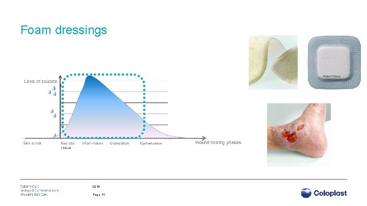 Foam dressings 2014 Page 11 