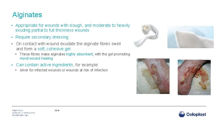 Alginates • Appropriate for wounds with slough, and moderate to heavily exuding partial to