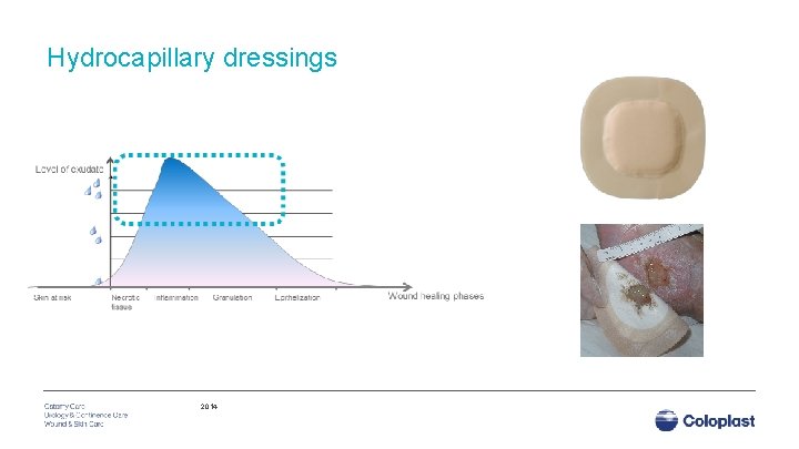 Hydrocapillary dressings 2014 