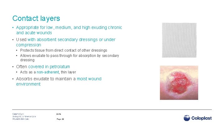 Contact layers • Appropriate for low, medium, and high exuding chronic and acute wounds