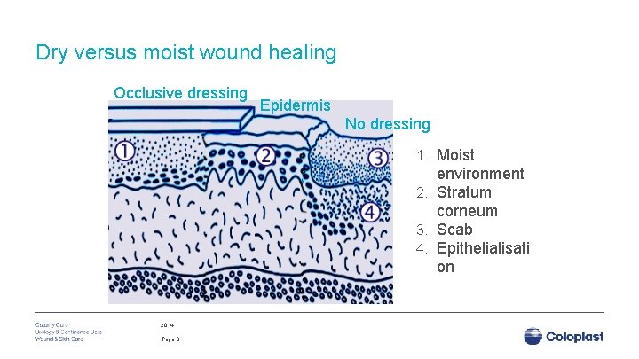 Dry versus moist wound healing Occlusive dressing Epidermis No dressing 1. Moist environment 2.