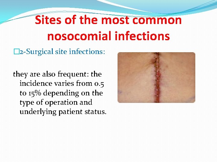 Sites of the most common nosocomial infections � 2 -Surgical site infections: they are