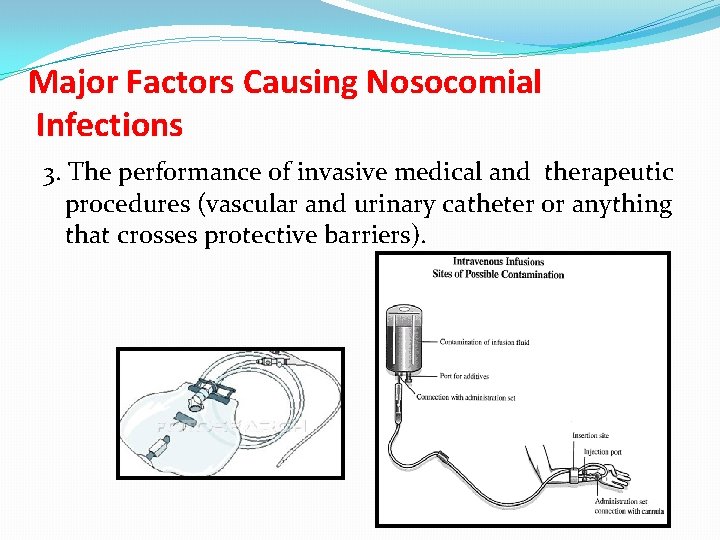 Major Factors Causing Nosocomial Infections 3. The performance of invasive medical and therapeutic procedures
