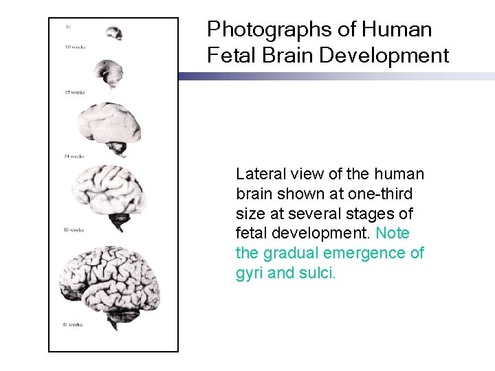 Photographs of Human Fetal Brain Development Lateral view of the human brain shown at
