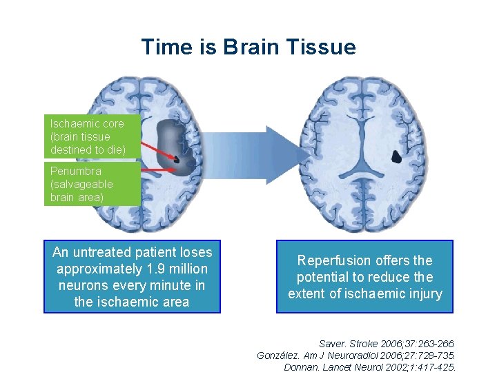 Time is Brain Tissue Ischaemic core (brain tissue destined to die) Penumbra (salvageable brain