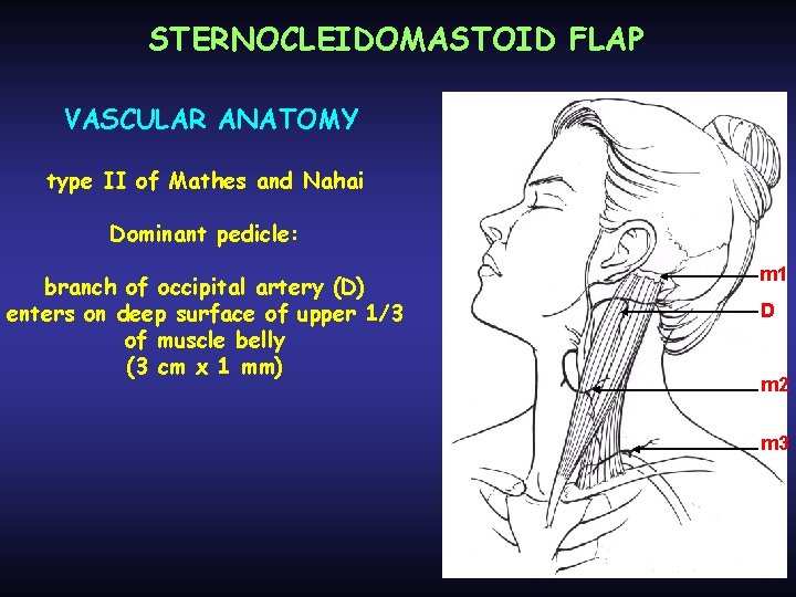 STERNOCLEIDOMASTOID FLAP VASCULAR ANATOMY type II of Mathes and Nahai Dominant pedicle: branch of