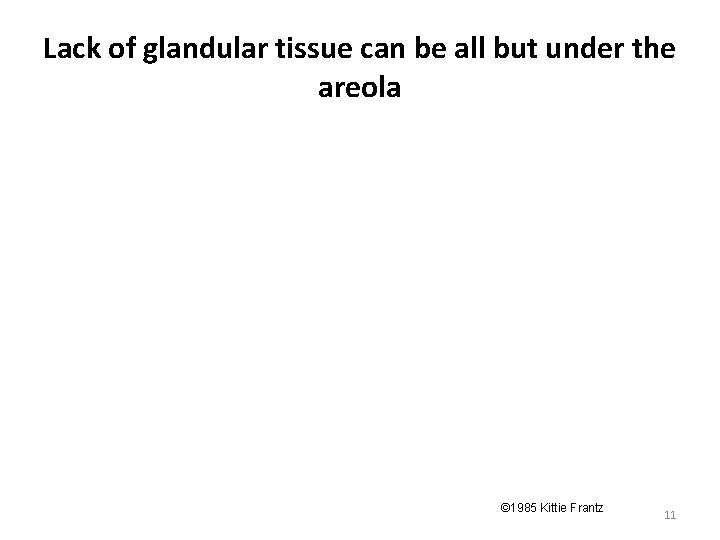 Lack of glandular tissue can be all but under the areola © 1985 Kittie Lack of glandular tissue can be all but under the areola © 1985 Kittie