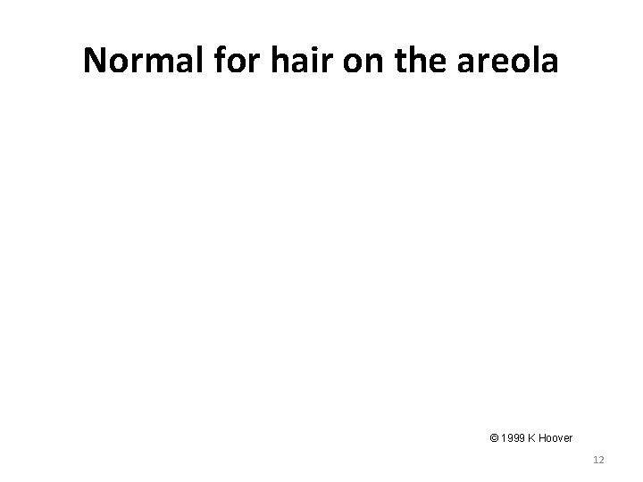 Normal for hair on the areola © 1999 K Hoover 12 Normal for hair on the areola © 1999 K Hoover 12