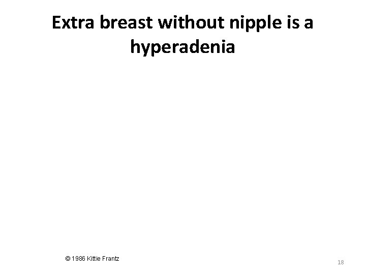 Extra breast without nipple is a hyperadenia © 1986 Kittie Frantz 18 Extra breast without nipple is a hyperadenia © 1986 Kittie Frantz 18