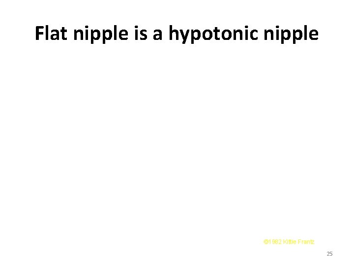 Flat nipple is a hypotonic nipple © 1982 Kittie Frantz 25 Flat nipple is a hypotonic nipple © 1982 Kittie Frantz 25