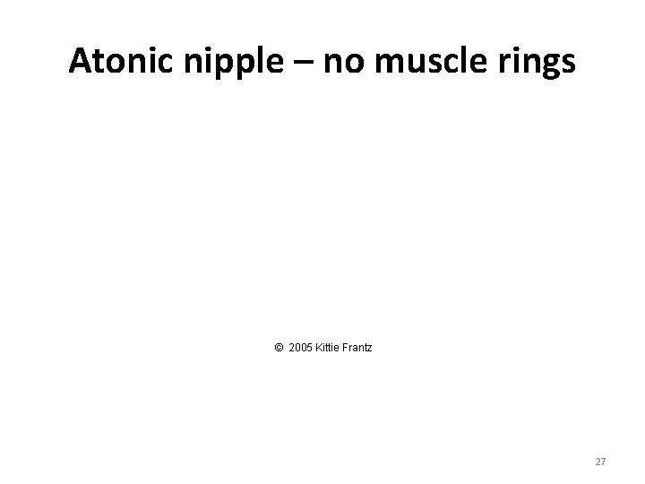 Atonic nipple – no muscle rings © 2005 Kittie Frantz 27 Atonic nipple – no muscle rings © 2005 Kittie Frantz 27