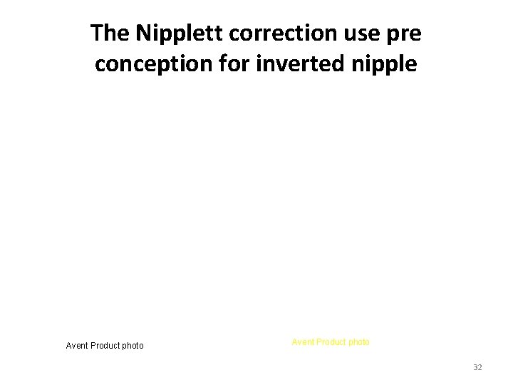 The Nipplett correction use pre conception for inverted nipple Avent Product photo 32 The Nipplett correction use pre conception for inverted nipple Avent Product photo 32