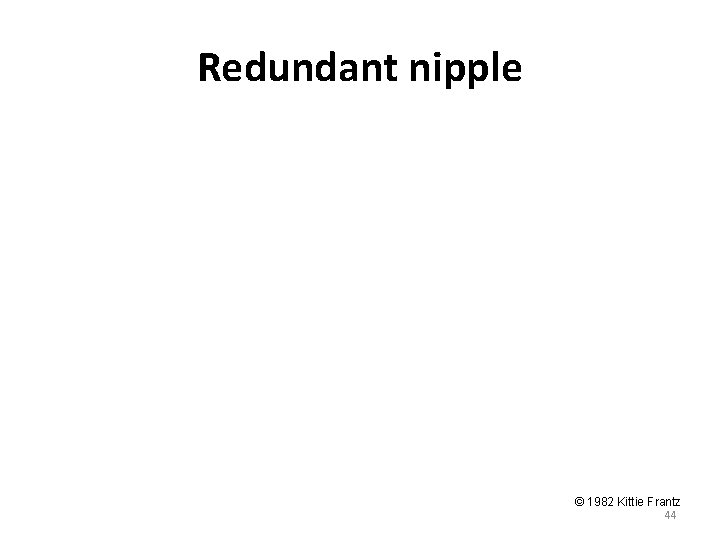 Redundant nipple © 1982 Kittie Frantz 44 Redundant nipple © 1982 Kittie Frantz 44