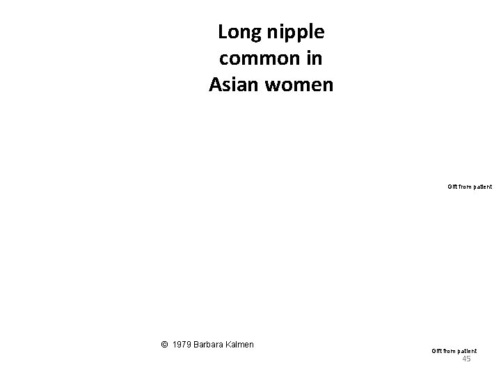 Long nipple common in Asian women Gift from patient © 1979 Barbara Kalmen Gift Long nipple common in Asian women Gift from patient © 1979 Barbara Kalmen Gift
