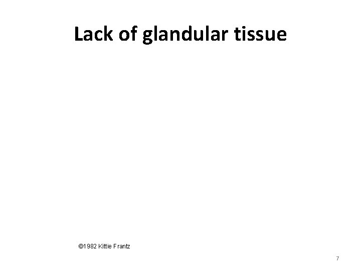 Lack of glandular tissue © 1982 Kittie Frantz 7 Lack of glandular tissue © 1982 Kittie Frantz 7