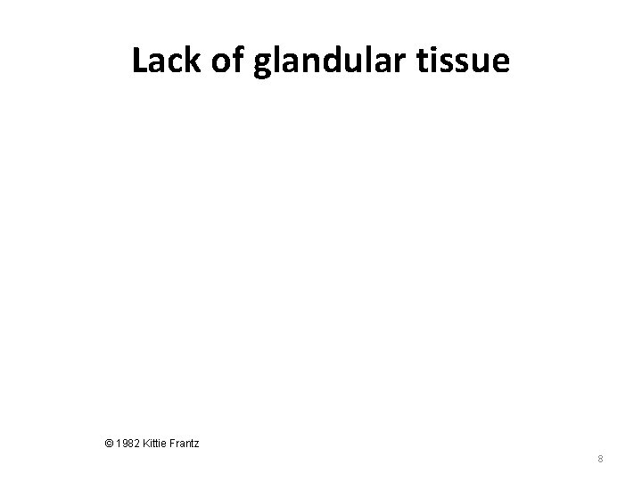 Lack of glandular tissue © 1982 Kittie Frantz 8 Lack of glandular tissue © 1982 Kittie Frantz 8