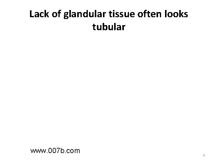 Lack of glandular tissue often looks tubular www. 007 b. com 9 Lack of glandular tissue often looks tubular www. 007 b. com 9