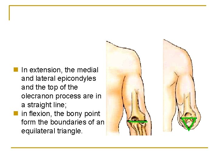 n In extension, the medial and lateral epicondyles and the top of the olecranon