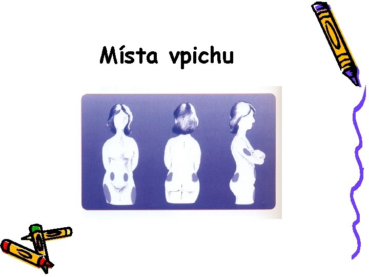 Místa vpichu 