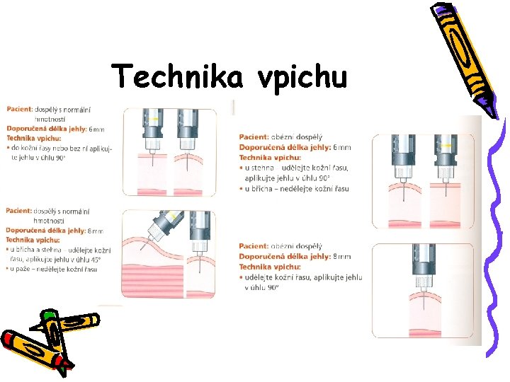 Technika vpichu 