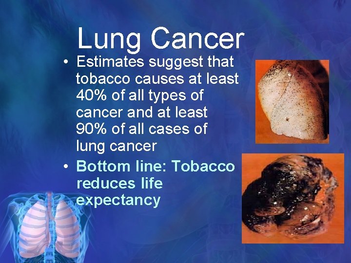 Lung Cancer • Estimates suggest that tobacco causes at least 40% of all types