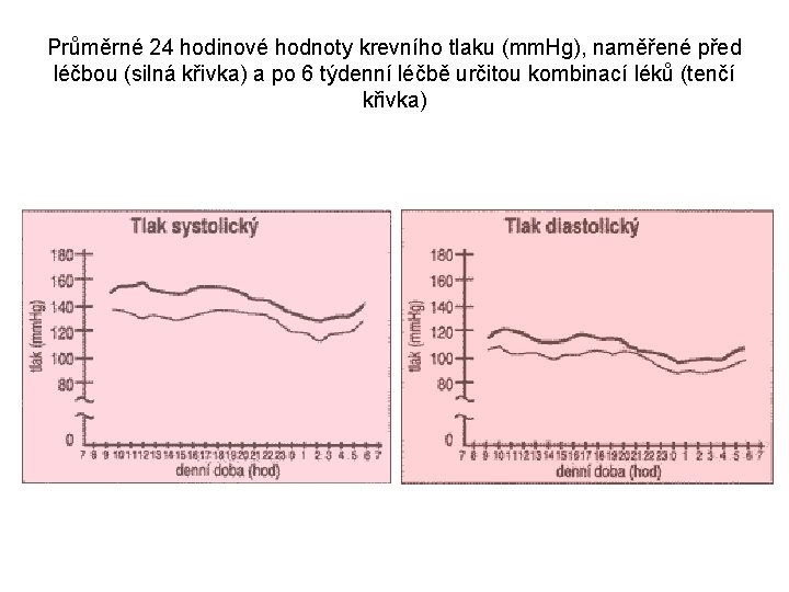 Průměrné 24 hodinové hodnoty krevního tlaku (mm. Hg), naměřené před léčbou (silná křivka) a