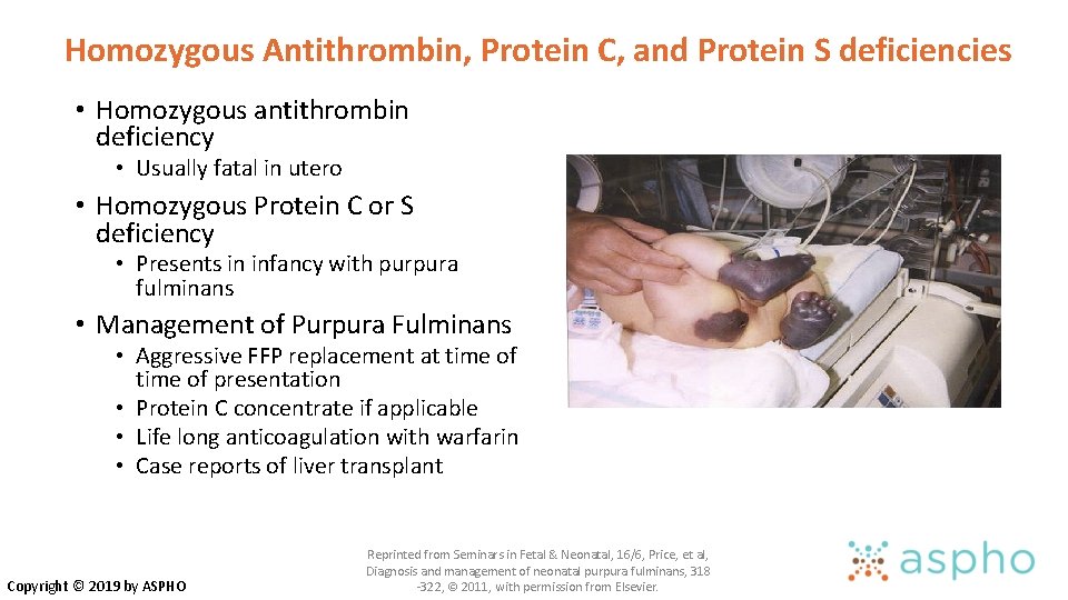 Homozygous Antithrombin, Protein C, and Protein S deficiencies • Homozygous antithrombin deficiency • Usually Homozygous Antithrombin, Protein C, and Protein S deficiencies • Homozygous antithrombin deficiency • Usually