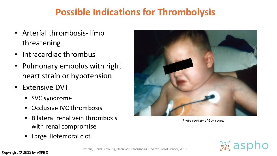 Possible Indications for Thrombolysis • Arterial thrombosis- limb threatening • Intracardiac thrombus • Pulmonary Possible Indications for Thrombolysis • Arterial thrombosis- limb threatening • Intracardiac thrombus • Pulmonary