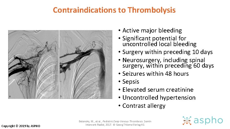 Contraindications to Thrombolysis • Active major bleeding • Significant potential for uncontrolled local bleeding Contraindications to Thrombolysis • Active major bleeding • Significant potential for uncontrolled local bleeding