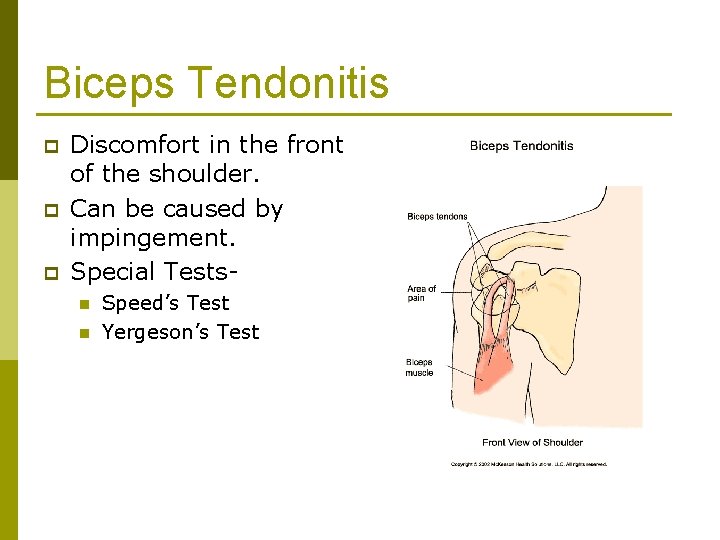 Biceps Tendonitis p p p Discomfort in the front of the shoulder. Can be