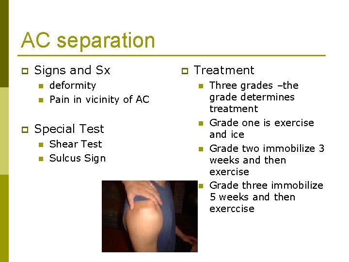 AC separation p Signs and Sx n n p deformity Pain in vicinity of