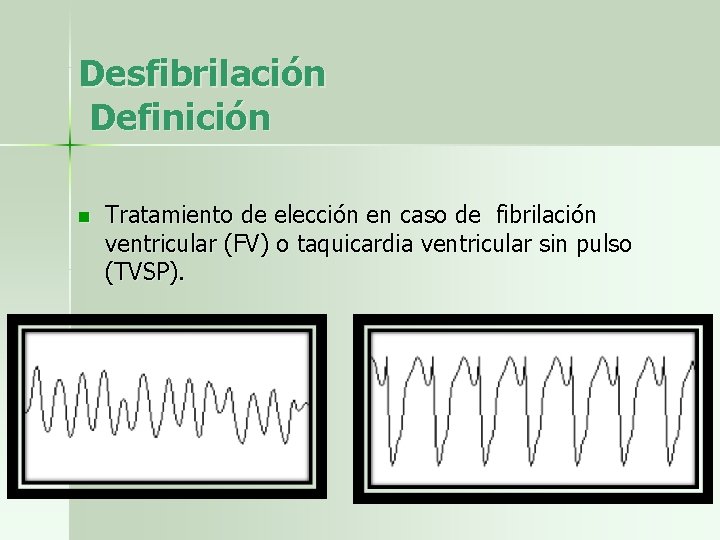 Desfibrilación Definición n Tratamiento de elección en caso de fibrilación ventricular (FV) o taquicardia