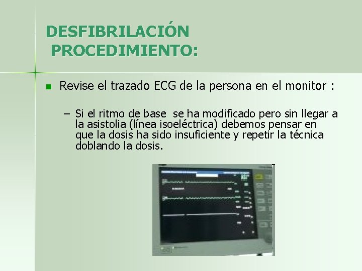 DESFIBRILACIÓN PROCEDIMIENTO: n Revise el trazado ECG de la persona en el monitor :