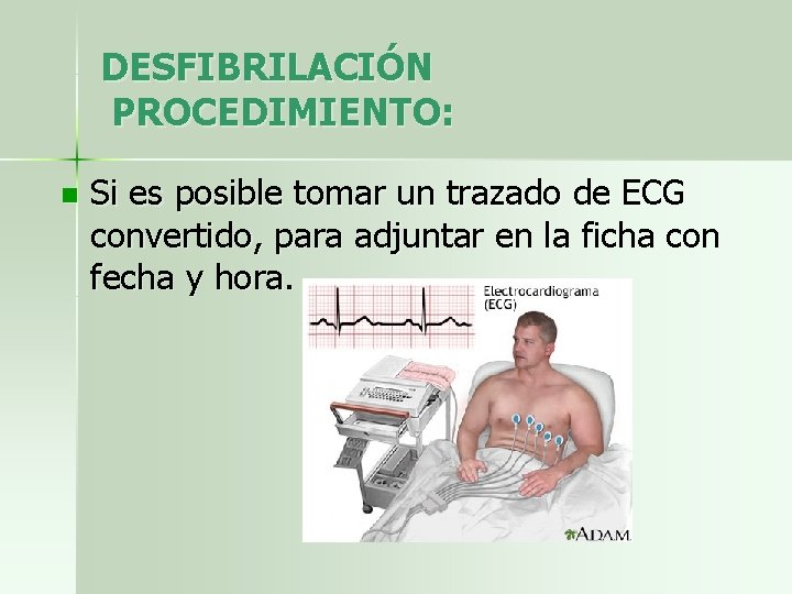 DESFIBRILACIÓN PROCEDIMIENTO: n Si es posible tomar un trazado de ECG convertido, para adjuntar
